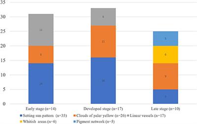 Dermoscopic Patterns in Juvenile Xanthogranuloma Based on the Histological Classification